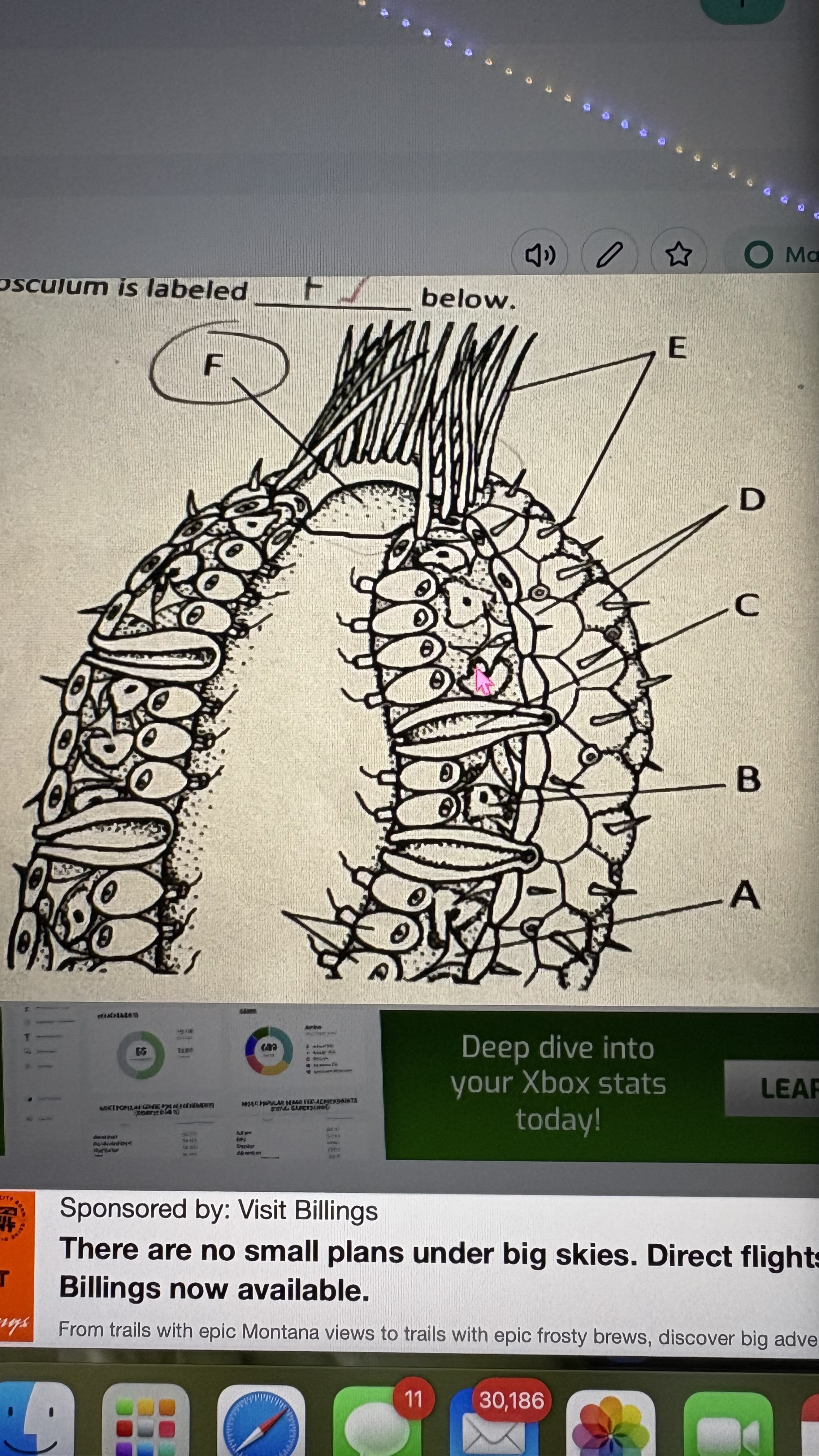<p>label choanocytes (collar cells) on scypha</p>