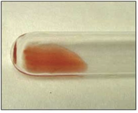 <p>Haemagglutination reaction</p>