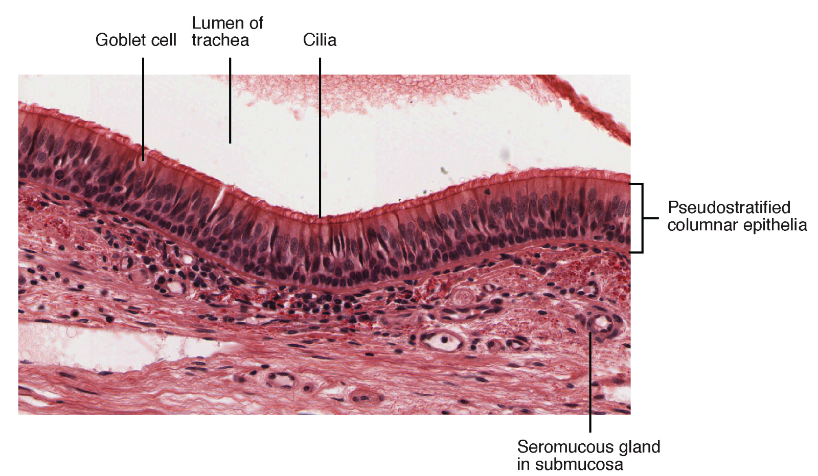 <ol start="4"><li><p><strong>Respiratory epithelium</strong></p></li></ol><ul><li><p>lines the conchae, meatuses, and paranasal sinuses</p></li><li><p>warm and humidify incoming air</p></li><li><p>composed of _________ ciliated ______ epithelium</p><ul><li><p><strong>Goblet cells</strong></p><ul><li><p>one of the specialized, columnar epithelial cells that produce _____ to trap debris</p></li></ul></li><li><p><strong>Cilia</strong></p><ul><li><p>help remove the mucus and debris from the nasal cavity with a constant _______ motion</p></li></ul></li><li><p><strong>Seromucous gland</strong></p><ul><li><p>secrete the _____ enzyme and proteins called ______, which have antimicrobial peptides (AMP)</p></li></ul></li><li><p><strong>Capillaries</strong></p><ul><li><p>located just beneath the nasal epithelium warm the air by _______</p></li></ul></li></ul></li></ul>