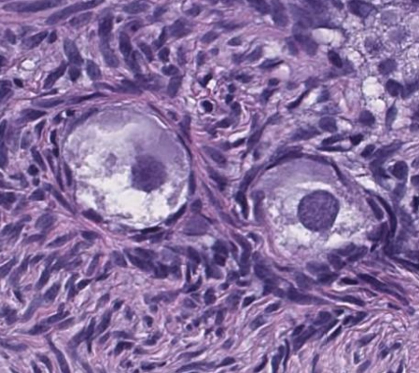 <p>the flattened cells surrounding the primordial follicle are ______ cells</p>