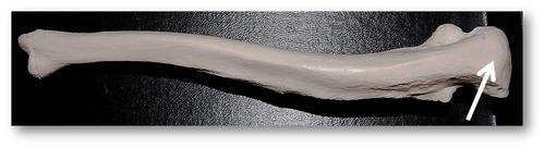 Name this specific part of the ulna.