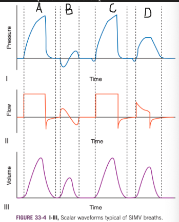 <ul><li><p><span>A - typical waveforms associated with a mandatory breath in SIMV-VC</span></p><ul><li><p><span>The shark fin pressure tracing and square wave flow tracing evident</span></p></li><li><p><span>No inspiratory hold has been prescribed so expiration begins once the target tidal volume is achieved</span></p></li><li><p><span>Before the initiation of inspiratory flow there is no evidence of patient effort (triggering)</span></p></li></ul></li><li><p><span>B - spontaneous breath</span></p><ul><li><p><span>Characteristic sine wave appearance</span></p></li><li><p><span>The negative portion of the pressure tracing is associated with inward flow because this is a spontaneous breath and not a positive pressure machine-delivered/assisted/supported breath</span></p></li><li><p><span>Tidal volume the patient achieves is lower than with a mandatory breath, which is what is typically observed (but not obligatory because it depends on patient effort and capacity)</span></p></li></ul></li><li><p><span>C - represents a synchronized, patient-triggered but machine-delivered breath</span></p><ul><li><p><span>The patient's inspiratory effort fell near to the time when the next mandatory breath was due</span></p><ul><li><p><span>The ventilator delivered a breath equivalent to the mandatory breath (A) but did so at a time synchronous with the patient's respiratory efforts</span></p></li></ul></li><li><p><span>The tidal volume is identical to that achieved in A</span></p></li><li><p><span>The patient's efforts only altered the timing of the breath, not its character</span></p></li><li><p><span>The nature of SIMV is such that there are preset periods immediately after a mandatory breath wherein the patient may breathe spontaneously and small time intervals before a mandatory breath during which patient efforts will trigger early delivery of the next ventilator delivered breath</span></p></li></ul></li><li><p><span>D - represents the waveforms typical of SIMV with pressure support</span></p><ul><li><p><span>The patient's inspiratory efforts for a spontaneous breath result in the ventilator delivering additional flow to supplement that achieved by the patient's own efforts</span></p></li><li><p><span>Pressure support is set to cease once a predetermined level of inspiratory flow is reached (e.g. 30% of peak flow)</span></p><ul><li><p><span>Reflected in the flow waveform by the fact that the inspiratory flow abruptly ceases at a level above zero</span></p></li></ul></li><li><p><span>Tidal volume achieved is larger than the patient achieved with a spontaneous breath (B) but smaller than the mandatory breaths (A and C)</span></p><ul><li><p><span>Equivalent tidal volumes could be achieved by increasing the level of pressure support</span></p></li></ul></li></ul></li></ul><p></p>