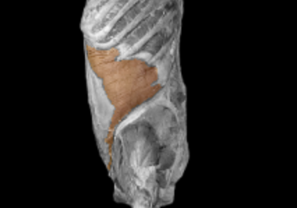 <p>What muscle is this?</p>