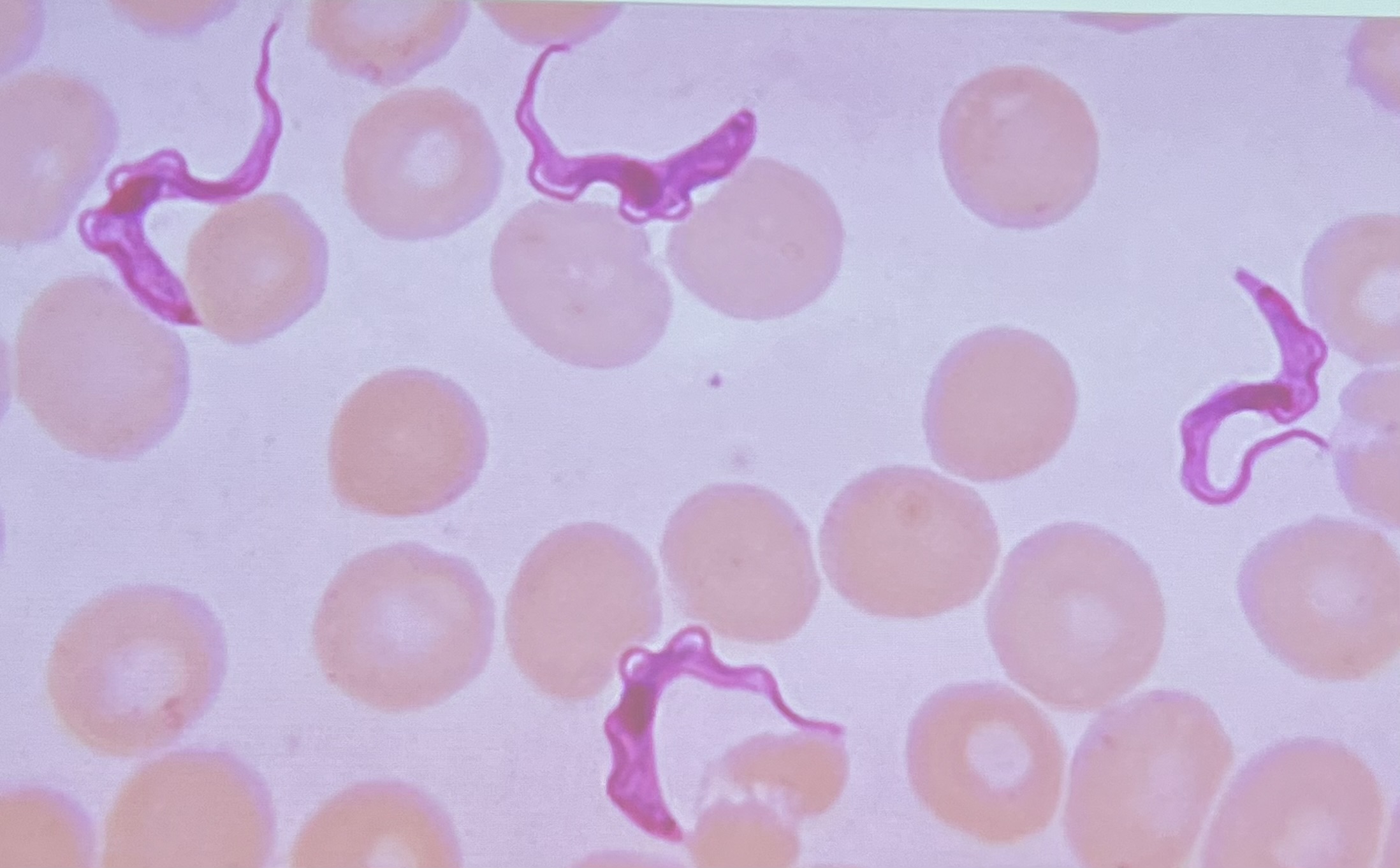 <p>Trophozoite only: “S” shape, undulating membrane, flagella, central nucleus </p>