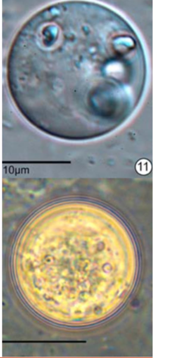 <p>II) Transmission by direct contact</p><p>Enables transmission from one bird to another bird</p><p>Via cloacal drinking;</p><p>After ingestion of the histomonads from environment:</p>
