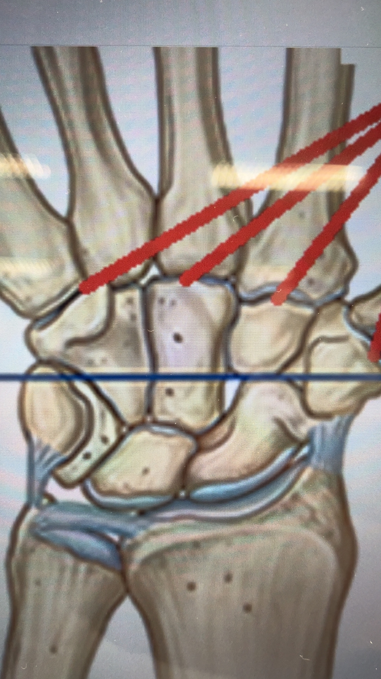 term image