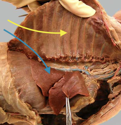 <p>blue arrow, sac covering the lung lobes</p>