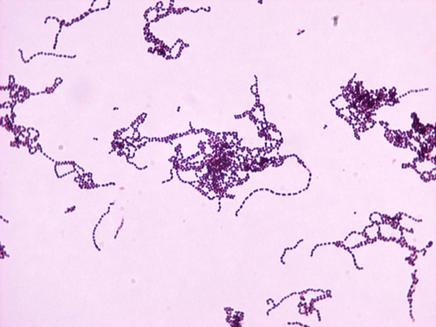 <p>gram-positive coccus, common in nose and mouth, cause of "strep throat"</p>