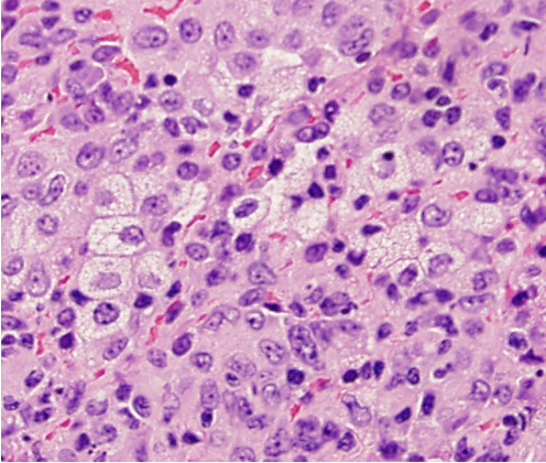 <p>What connective tissue cell is shown in the following image?</p>