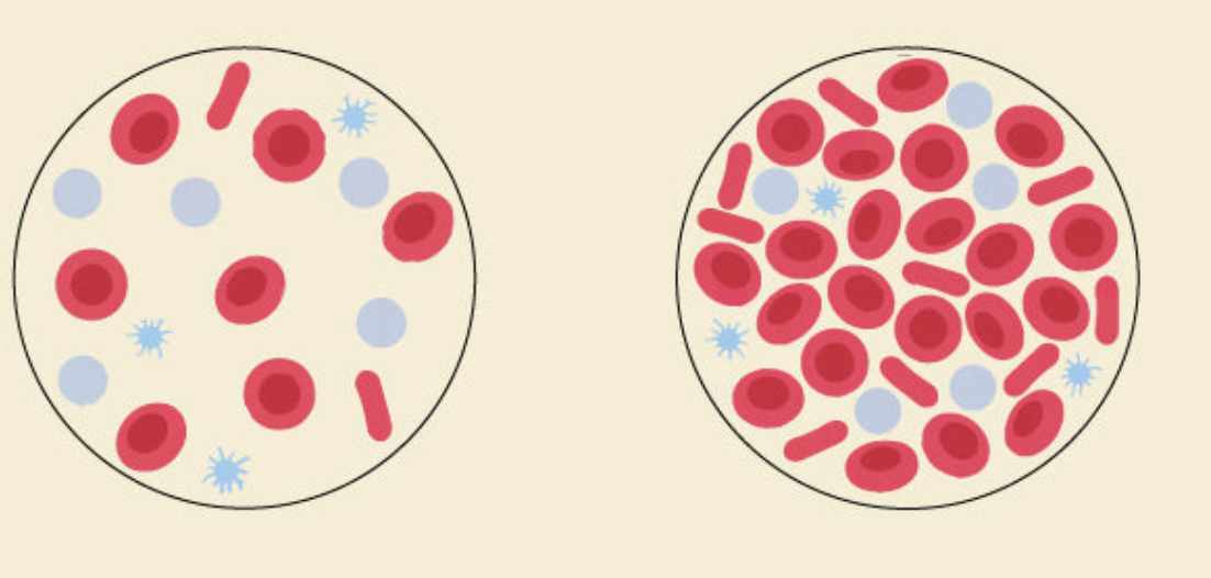 <p>what are the erythrocyte disorders of blood?</p>