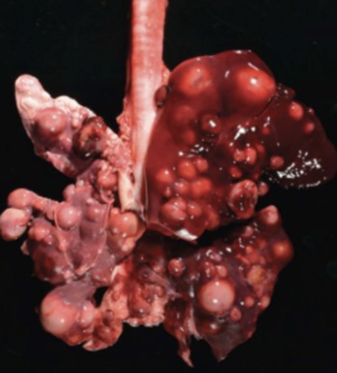 <p>What kind of tumor is this? (broad category)</p>