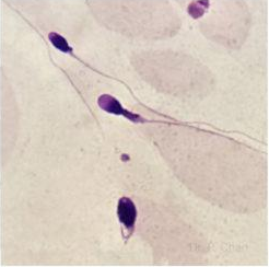 <p>Identify the sperm morphology.</p>
