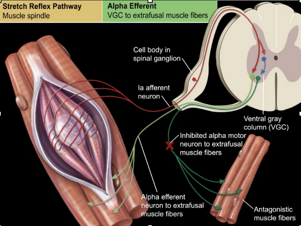 <p><u>Efferent Pathway:</u></p><ul><li><p>Efferent nerve cell body lies WITHIN the gray matter of the VENTRAL horn, communicates directly with the afferent nerve in here</p><ul><li><p>NO INTERNEURON </p></li></ul></li><li><p>Signal of <strong>alpha efferent neuron </strong>is sent to the EXTRAFUSAL muscle fibers of the tendon, triggering a contraction </p><ul><li><p>At the same time, has to INHIBIT ANTAGONISTIC MUSCLE FIBERS, so a different alpha motor neuron that has received the same signal from the afferent neuron is stimulated</p><ul><li><p>Sends a signal to inhibit the contraction of antagonistic flexor muscles, allowing for the involuntary extension of the patella </p></li></ul></li></ul></li></ul><p></p>