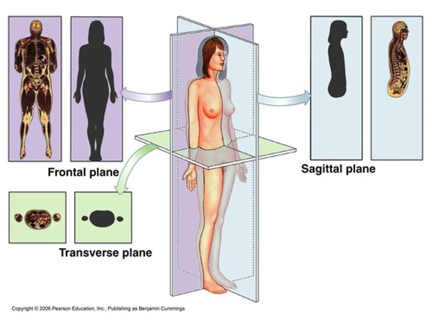 <p>A longitudinal section that divides the body into left and right sides.</p>