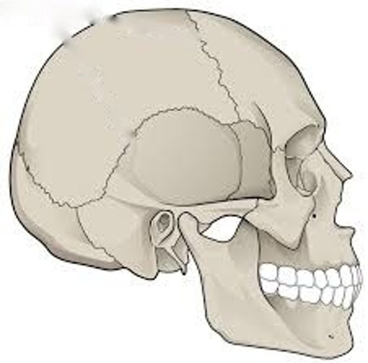 <p>one bone is fused to another</p><p>Examples: the frontal bone just above the nasal bone, sutures between skull bones</p>