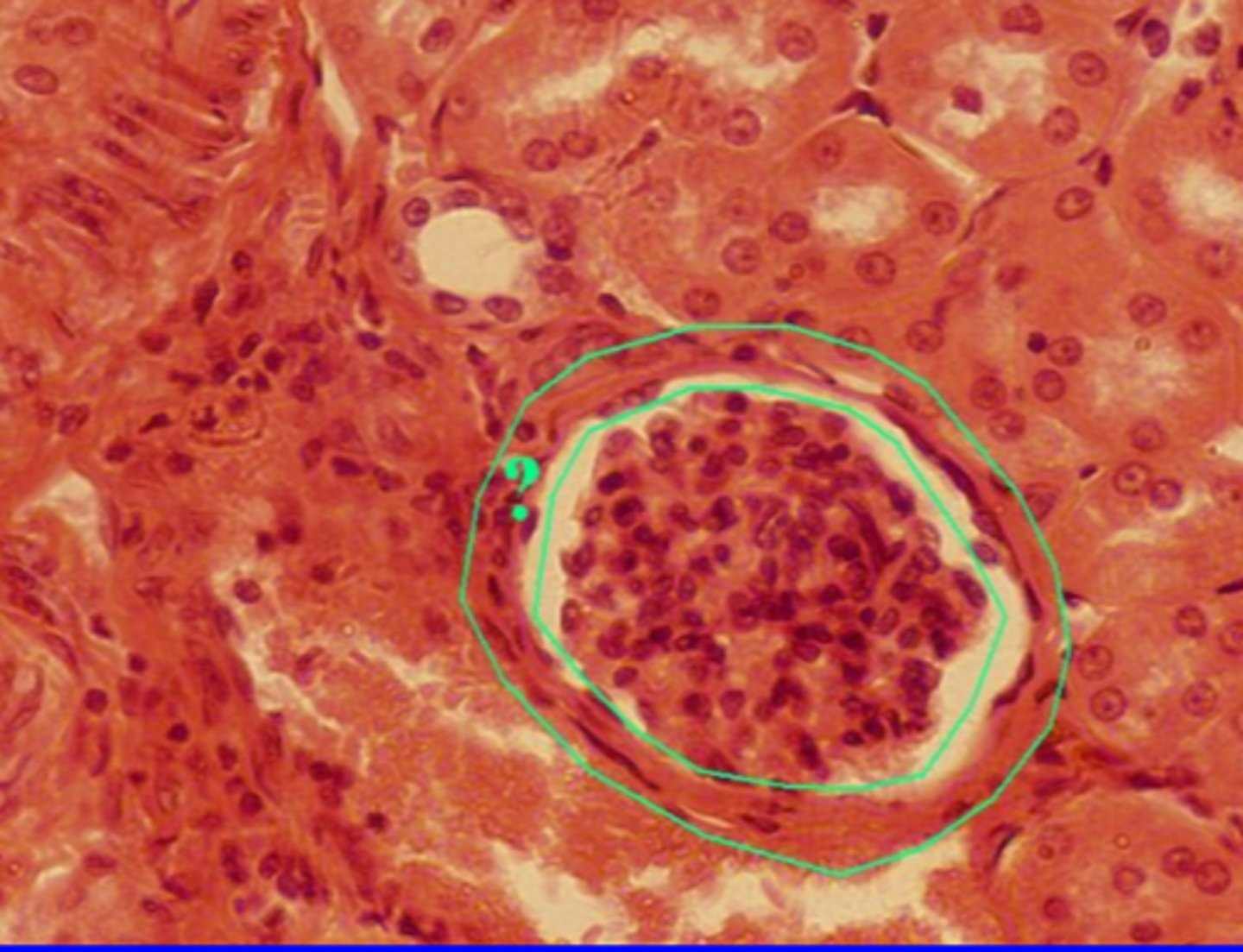 <p>Single layer of flat cells</p><p>Location: alveoli of the lungs, kidney glomeruli, and endothelial linings of blood vessels</p><p>Function: provide a short path for rapid diffusion</p>