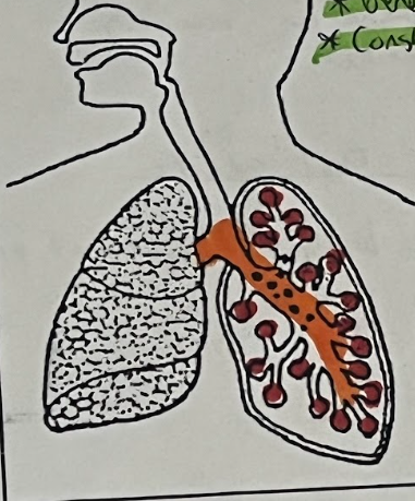 <p>Lungs (Bronchioles &amp; Alveoli)</p>
