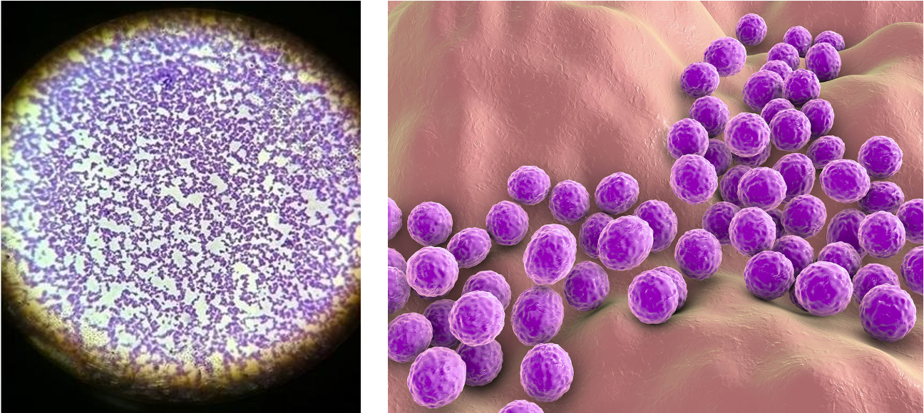 <p>gram positive cocci in irregular grape like clusters; facultative anaerobic organisms</p>