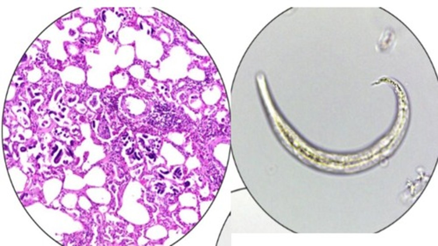 <p>Lungworm that infects the bronchioles & lung parenchyma of sheep & goats</p><p>-L4 are found in lung parenchyma & form nodules where adults develop</p><p>-L1 have a wavy, pointed tail with dorsal spine & are found in feces --> Baermann technique</p>