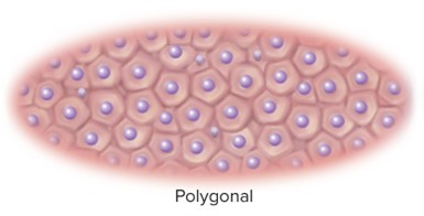 <p>Polygonal</p>