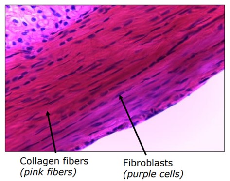 <p>What type of connective tissue is this</p>