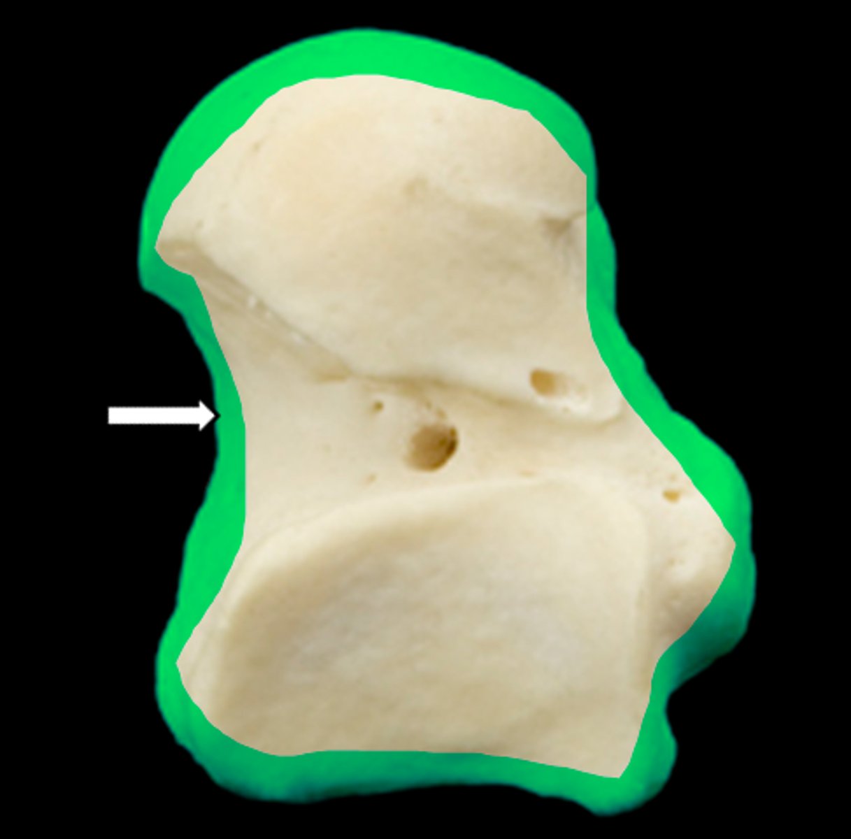 <p>name the part</p>