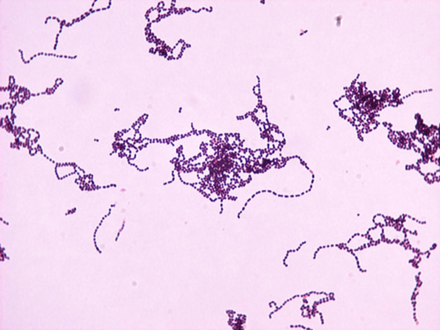 <p>- infections of skin and blood</p><p>- ex: pharyngitis, pneumonia, scarlet & rheumatic fever</p><p>- carriage = 10-20%</p><p>- gram POSITIVE cocci in CHAINS</p><p>- catalase = negative</p><p>- produces exotoxins, exoenzymes, superantigens</p><p>- not very resistant; can still use beta-lactams</p>
