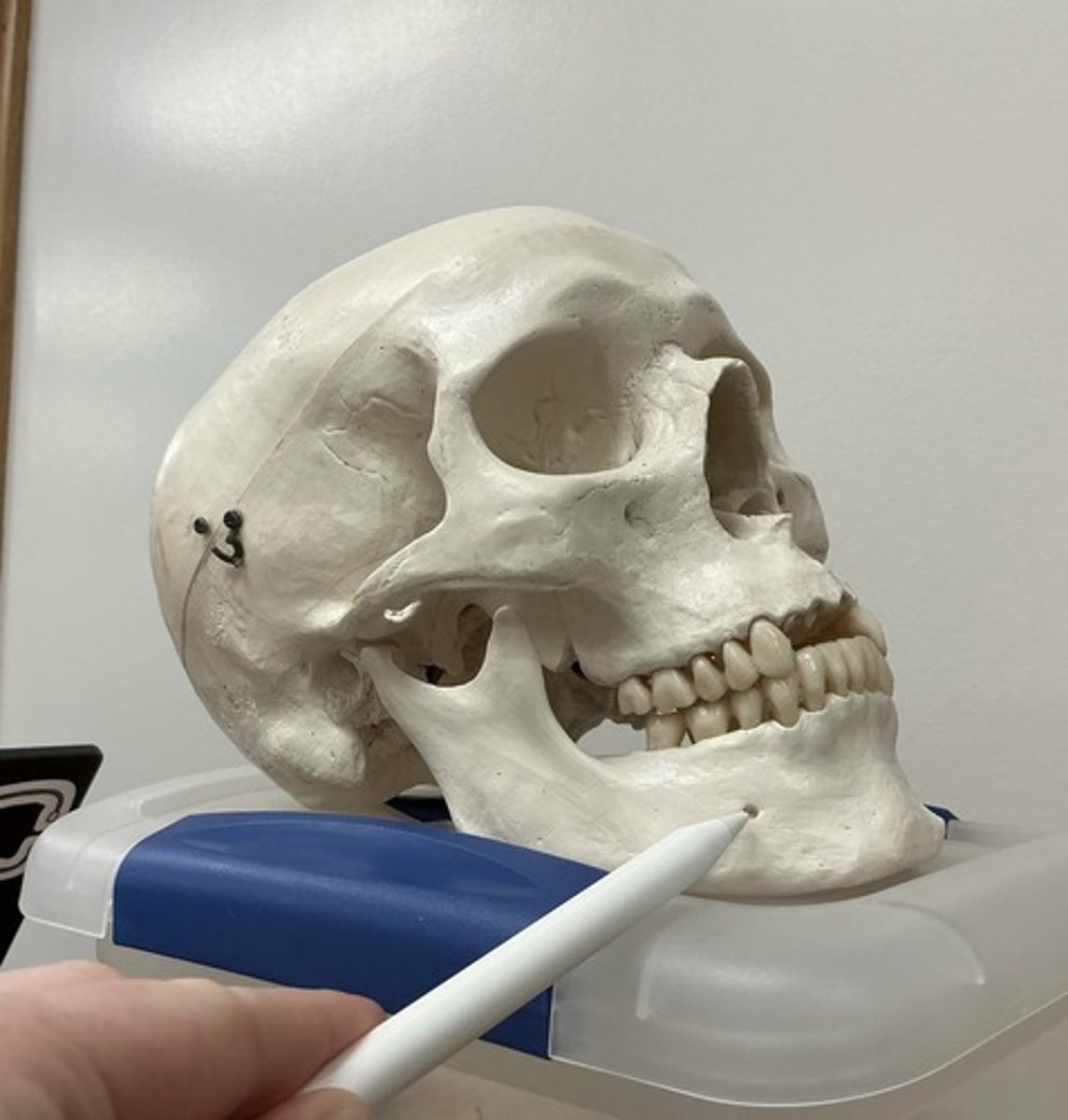 <p>What is the arrow pointing to?</p>