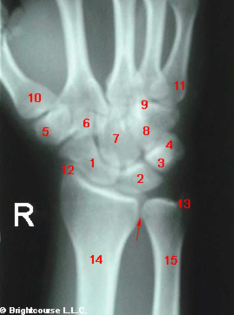 <p>What structure is indicated by number 13?</p>