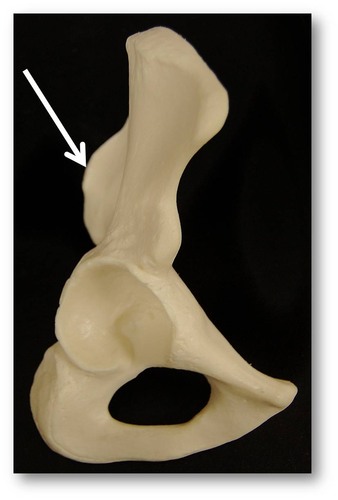 Name this specific part of the pelvic bone.