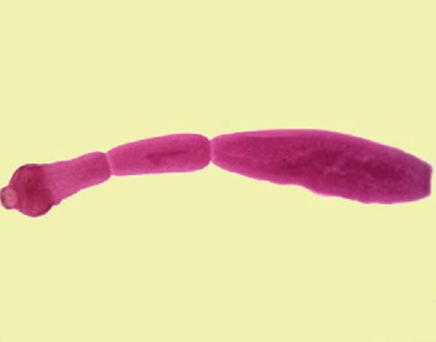 <p>c. Echinococcus granulosus</p>