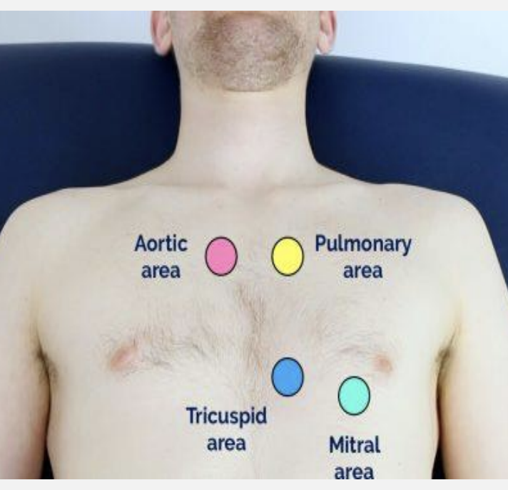 <p>-aortic -pulmonic -earbs -tricuspid -mitral</p>