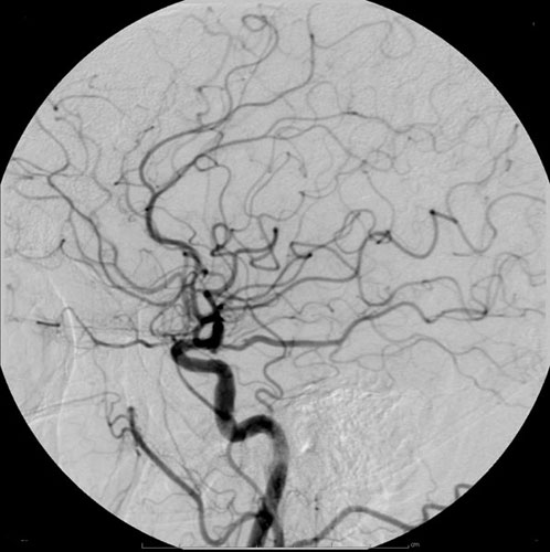 <p>Visualizing Blood vessels</p>