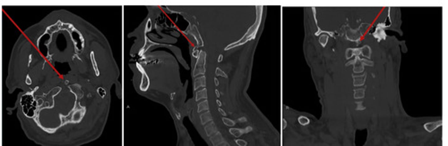 <p>What anomaly is this?</p>