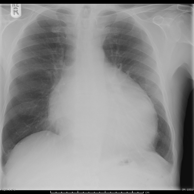 <p>Describe the abnormality demonstrated.</p>