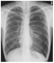 <p>What chest projection is this?</p>