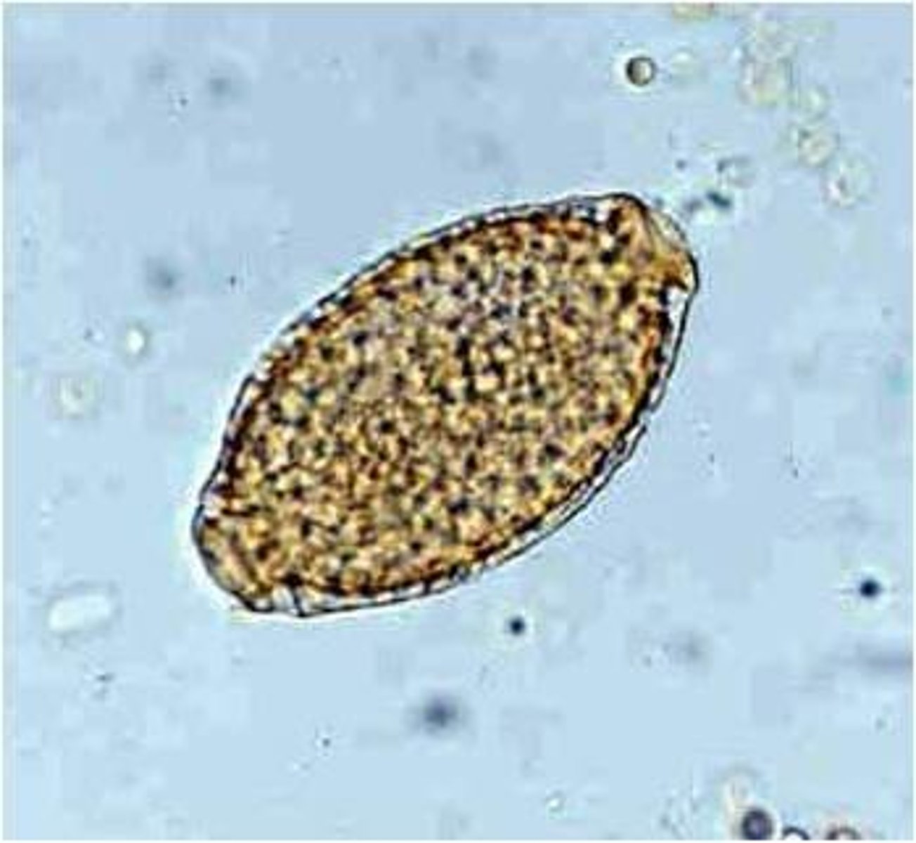 <p>Pearsonema plica</p>