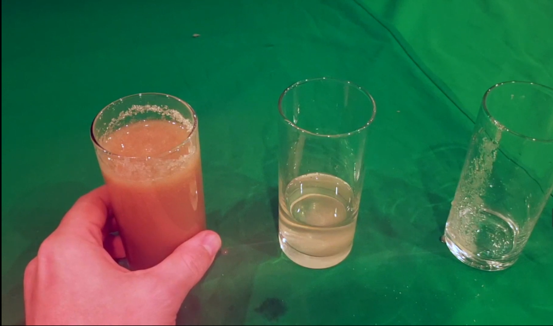<ul><li><p>Two types: Type 1 and Type 2</p></li><li><p>Type 1 (Hyposecretion) usually results from an autoimmune disease and is caused by a lack of insulin</p></li><li><p>Type 2 (Hypoactivity) is caused by excessive sugar in the blood, leading to insulin receptors being dulled and becoming inactive (Can be reversed)</p></li></ul><p></p>