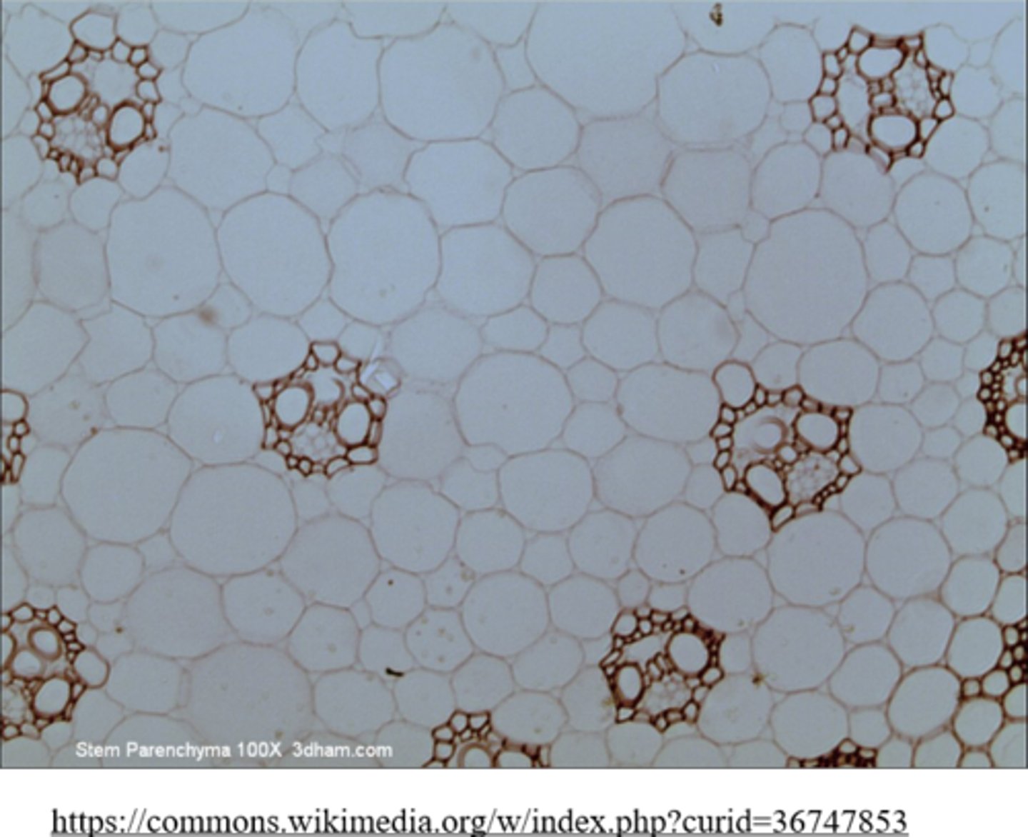 <p>parenchyma</p>