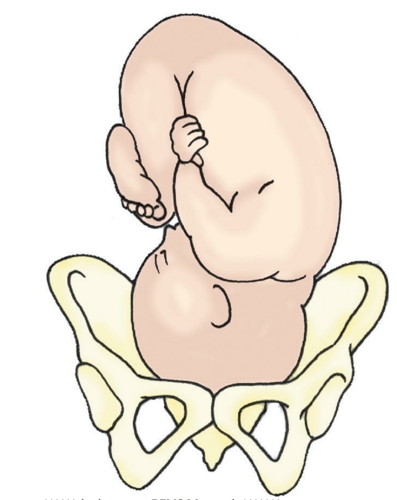 <p>The nurse is assessing fetal position for a 32-year-old client in her 8th month of pregnancy. As shown below, the fetus is in which position?</p><p>□ 1. left occipital transverse</p><p>□ 2. left occipital anterior</p><p>□ 3. right occipital transverse</p><p>□ 4. right occipital anterior</p>