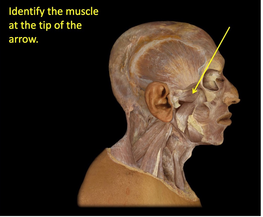 <p>(review) identify the muscle at the tip of the arrow</p>