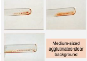 <p>Agglutination Grading</p>