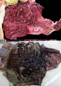 <p>What is this condition. Explain its pathogenesis and give risk factors (4).</p>