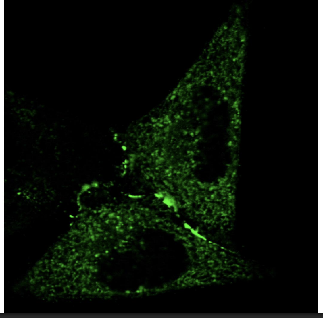 <p>How to create a GFP <strong>pulse</strong> to map the secretory pathway</p>