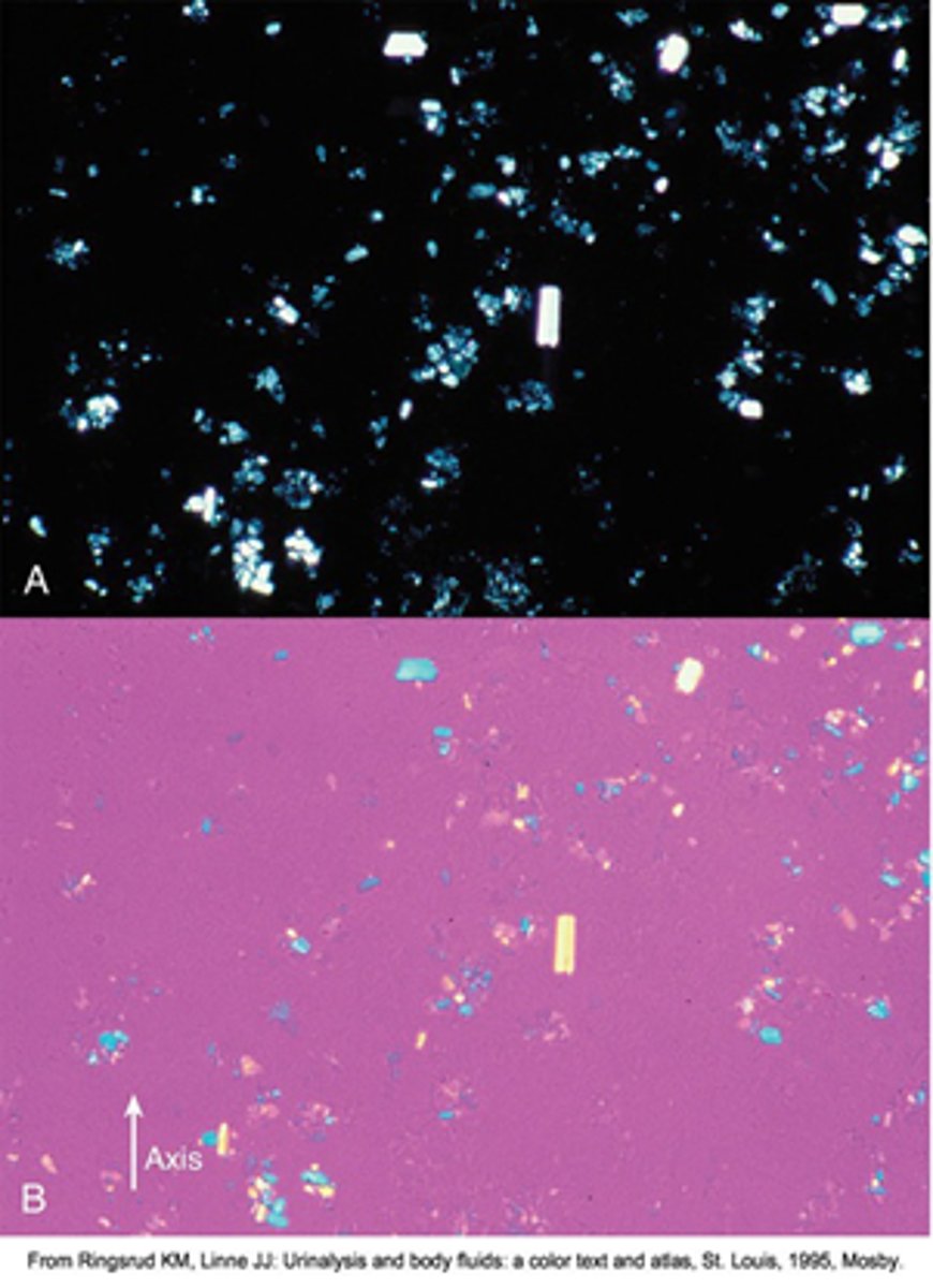 <p>Intracellular</p>