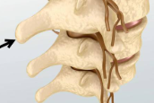 <p>T1- T2 (top to bottom of spine</p>