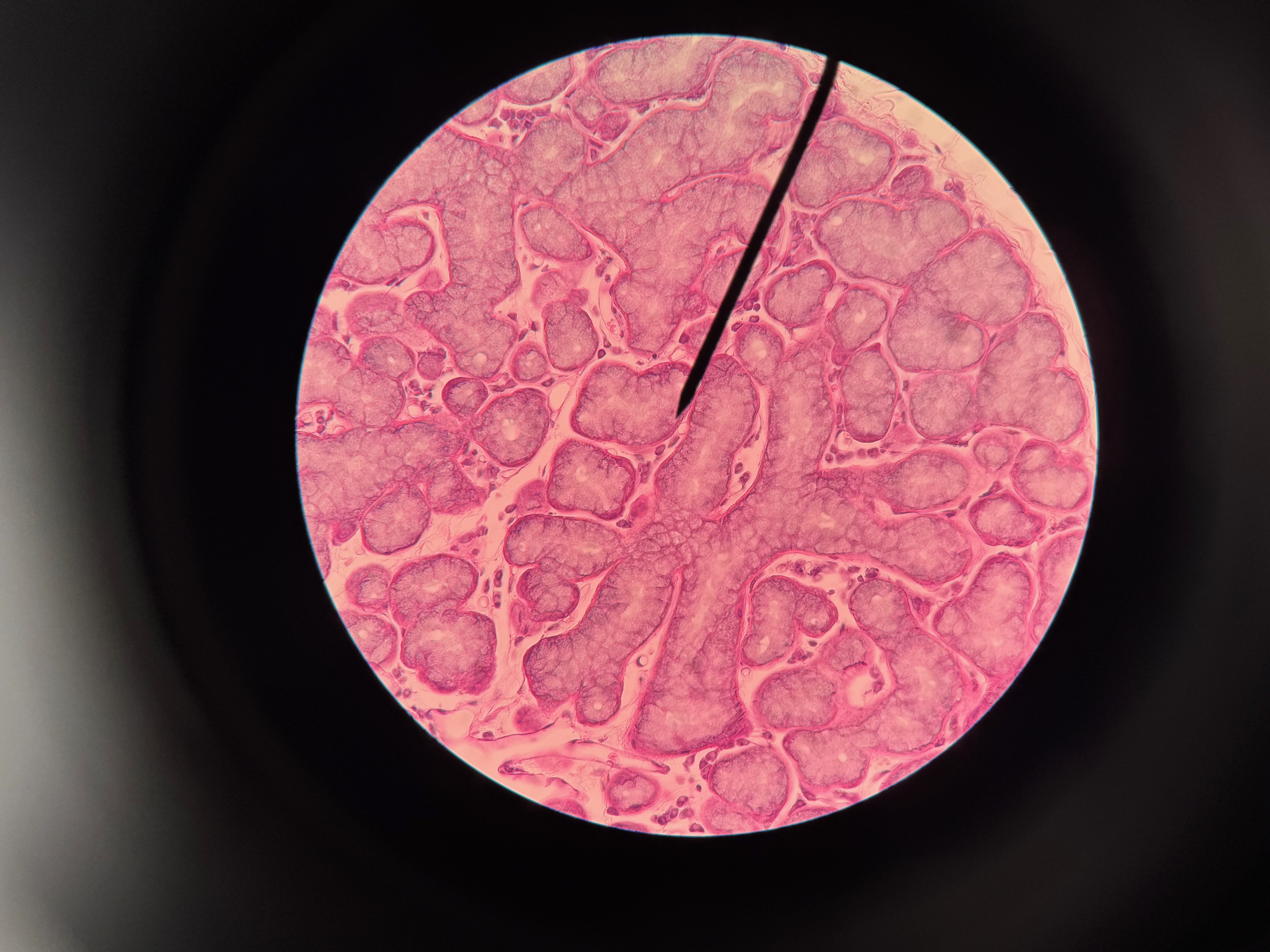 <p>Organ?</p>