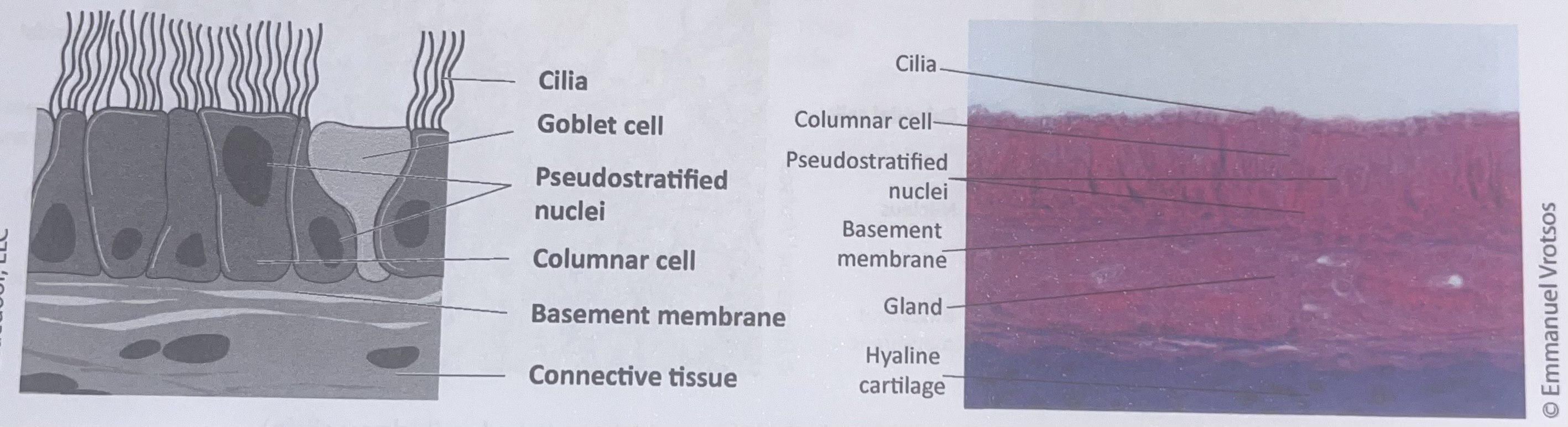 <p>pseudostratified columnar epithelium&nbsp;</p>