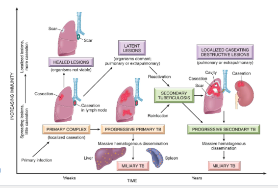 <ol><li><p>vigorous immune response</p><ol><li><p><span>Healing of apical lesion</span></p></li><li><p><span>Containment of the infection; no further spread of organism</span></p></li></ol></li><li><p>fibrous wall breaks down</p><ol><li><p>reactivated fibrocaseous TB</p></li></ol></li></ol><p></p>