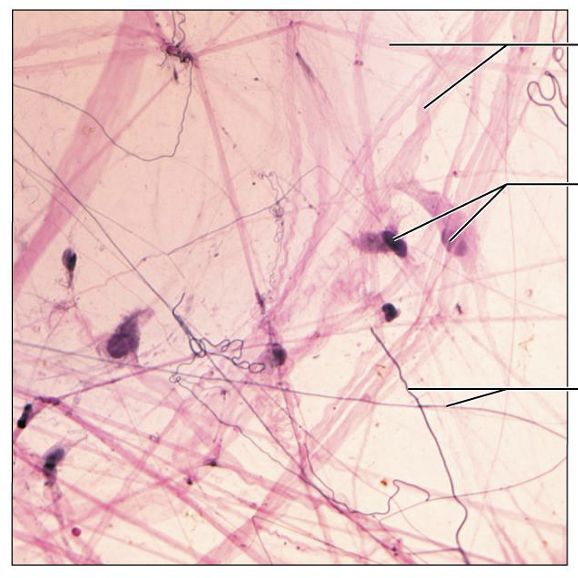 <p>What is this tissue, and where is it found?</p>
